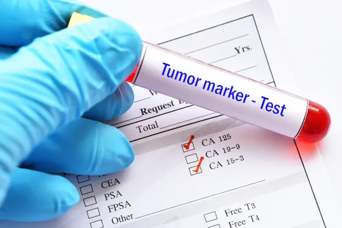 tumour